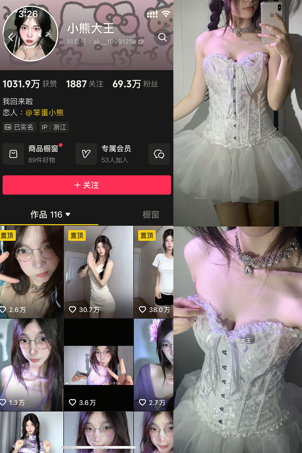 抖音 小熊大王 微密圈 001期 【32P】-维密小圈